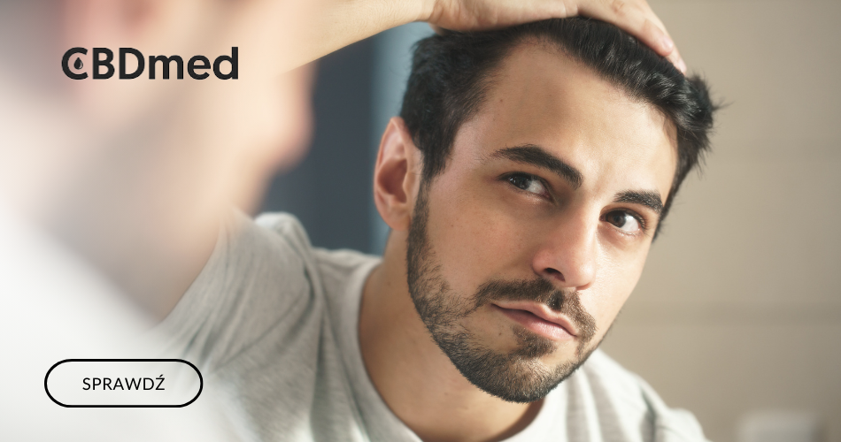 CBD a łysienie – kannabidiol w walce z wypadającymi włosami